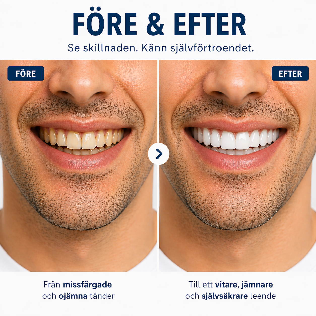 Nordelle® Kosmetiska Löständer