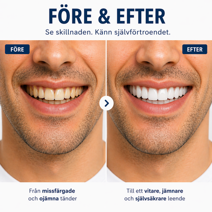 Nordelle® Kosmetiska Löständer